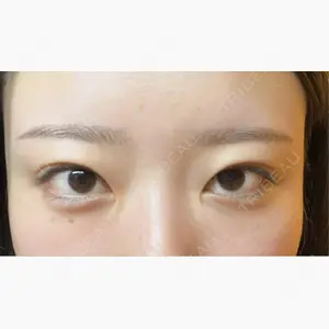 湘南美容クリニック 池袋東口院口コミ