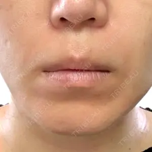 B-LINE CLINIC 池袋院口コミ