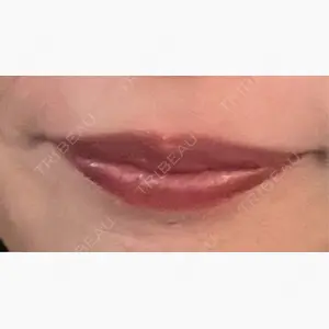 おおたかの森ビューティークリニック口コミ