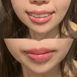 PRO CLINIC プロクリニック 銀座院口コミ