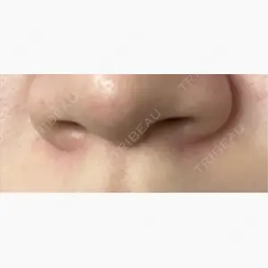 eクリニック 福岡院口コミ