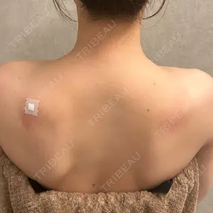 BiBiクリニック口コミ