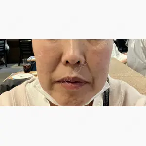 Natural Skin Clinic 笹塚院口コミ
