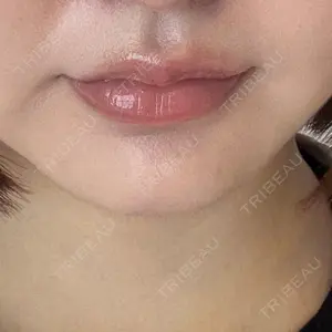 ルラ美容クリニック 札幌院口コミ
