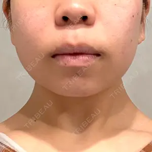 RIVER CLINIC（リバークリニック）口コミ
