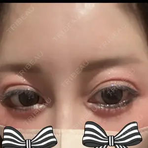 吉祥寺アイビークリニック口コミ