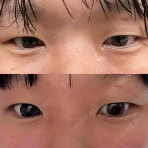 NARU Beauty Clinic 【ナルクリ】口コミ