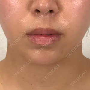 アリエル美容クリニック 横浜院口コミ