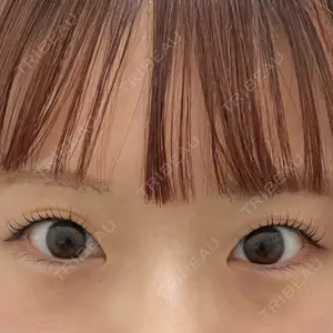 フィラークリニック 大阪梅田院口コミ
