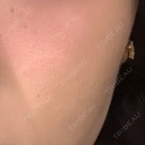 DAILY SKIN CLINIC 福岡院口コミ