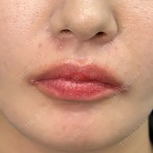 ルラ美容クリニック 渋谷本院口コミ