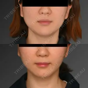 Lipo Clinic omotesando口コミ