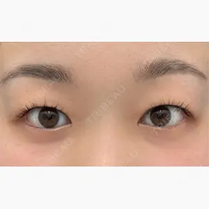 湘南美容クリニック 池袋東口院口コミ