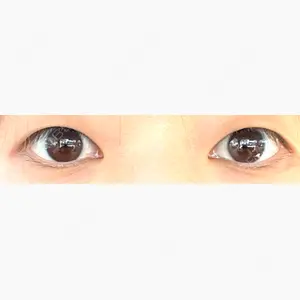LUHO（ルホ）美容外科口コミ