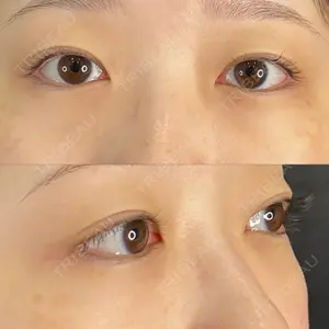 藤・ナチュレ美容クリニック 銀座院口コミ