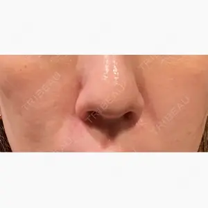 BiBiクリニック口コミ