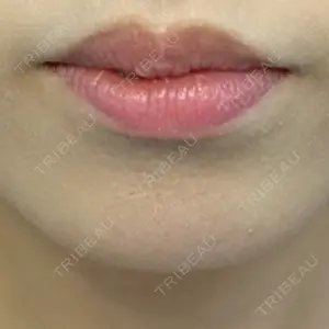 ルラ美容クリニック 渋谷本院口コミ