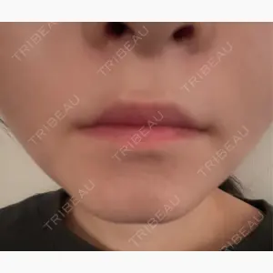 PRISM Beauty Clinic口コミ