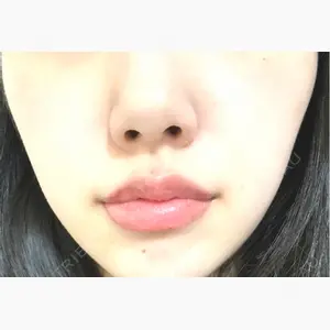 ルラ美容クリニック 町田院口コミ