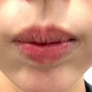 シェリークリニック 福岡院口コミ
