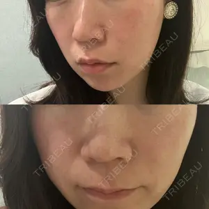 ルラ美容クリニック 仙台院口コミ