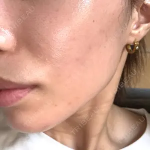 ルラ美容クリニック 池袋院口コミ