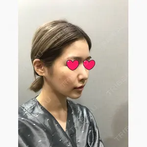 TJ美容外科口コミ