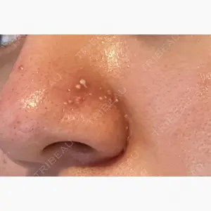 ライズワン美容皮膚科クリニック口コミ