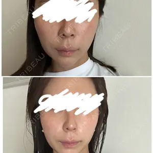 EMMO FACE CLINIC 東京三田院口コミ