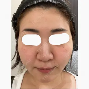 東京美容医療クリニック 池袋院口コミ