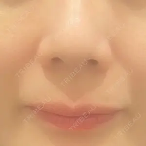 YBC横浜美容外科 立川院口コミ