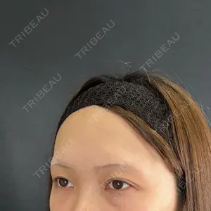 藤・ナチュレ美容クリニック 銀座院口コミ