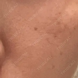 オーキッド美容クリニック東京御徒町口コミ