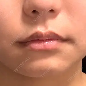 銀座美容外科クリニック 銀座院口コミ