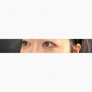 藤・ナチュレ美容クリニック 銀座院口コミ