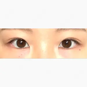 ネビュラクリニック 東京錦糸町院口コミ