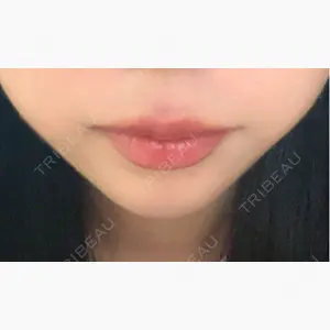 ルラ美容クリニック 大宮院口コミ