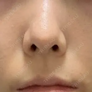 聖心美容クリニック 銀座院口コミ