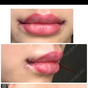 PRO CLINIC プロクリニック 銀座院口コミ
