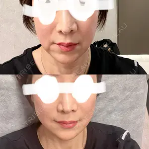 BiBiクリニック口コミ