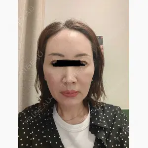 PRO CLINIC プロクリニック 銀座院口コミ