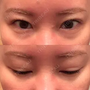 藤・ナチュレ美容クリニック 銀座院口コミ