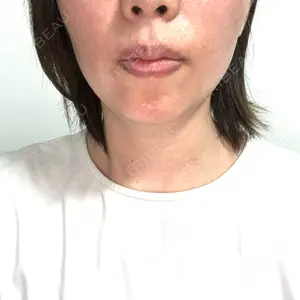 メディカルアルファクリニック口コミ