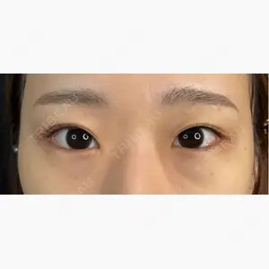 藤・ナチュレ美容クリニック 銀座院口コミ