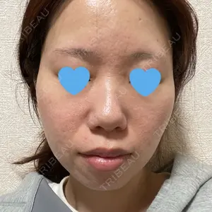 ミニマムスキンクリニック池袋口コミ