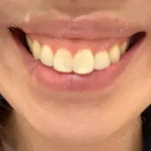 BON BON CLINIC 銀座駅前本院口コミ