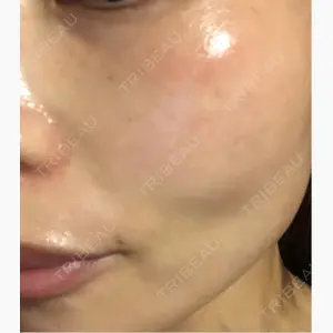 Ledian Clinic六本木口コミ