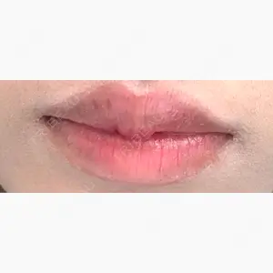 銀座美容外科クリニック 銀座院口コミ