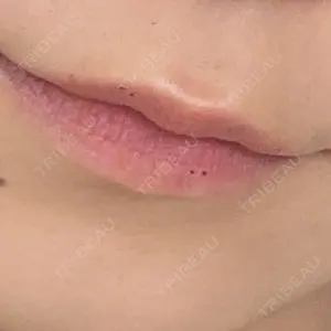 PRO CLINIC プロクリニック 銀座院口コミ