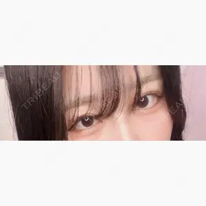 フィラークリニック 大阪心斎橋院口コミ